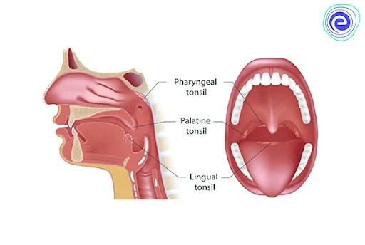 Types of Tonsils