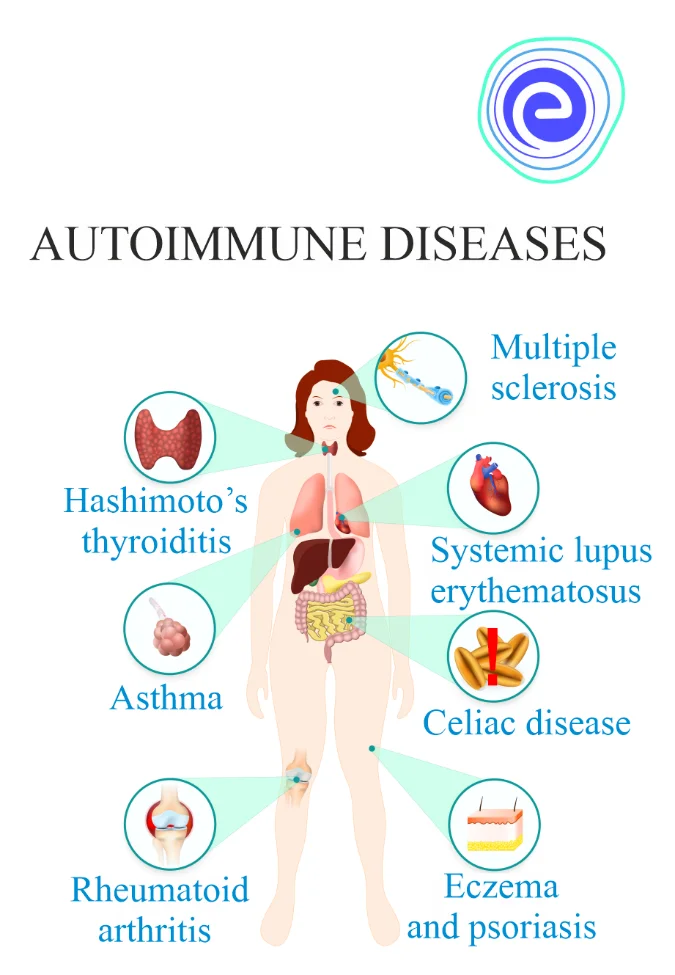 Various Autoimmune Diseases